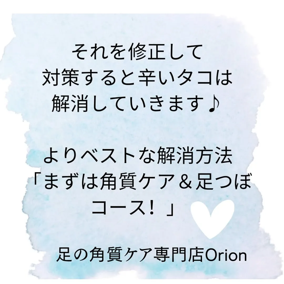 小指の上のタコ！ベストな解消方法は⁉️痛いの我慢はOK？