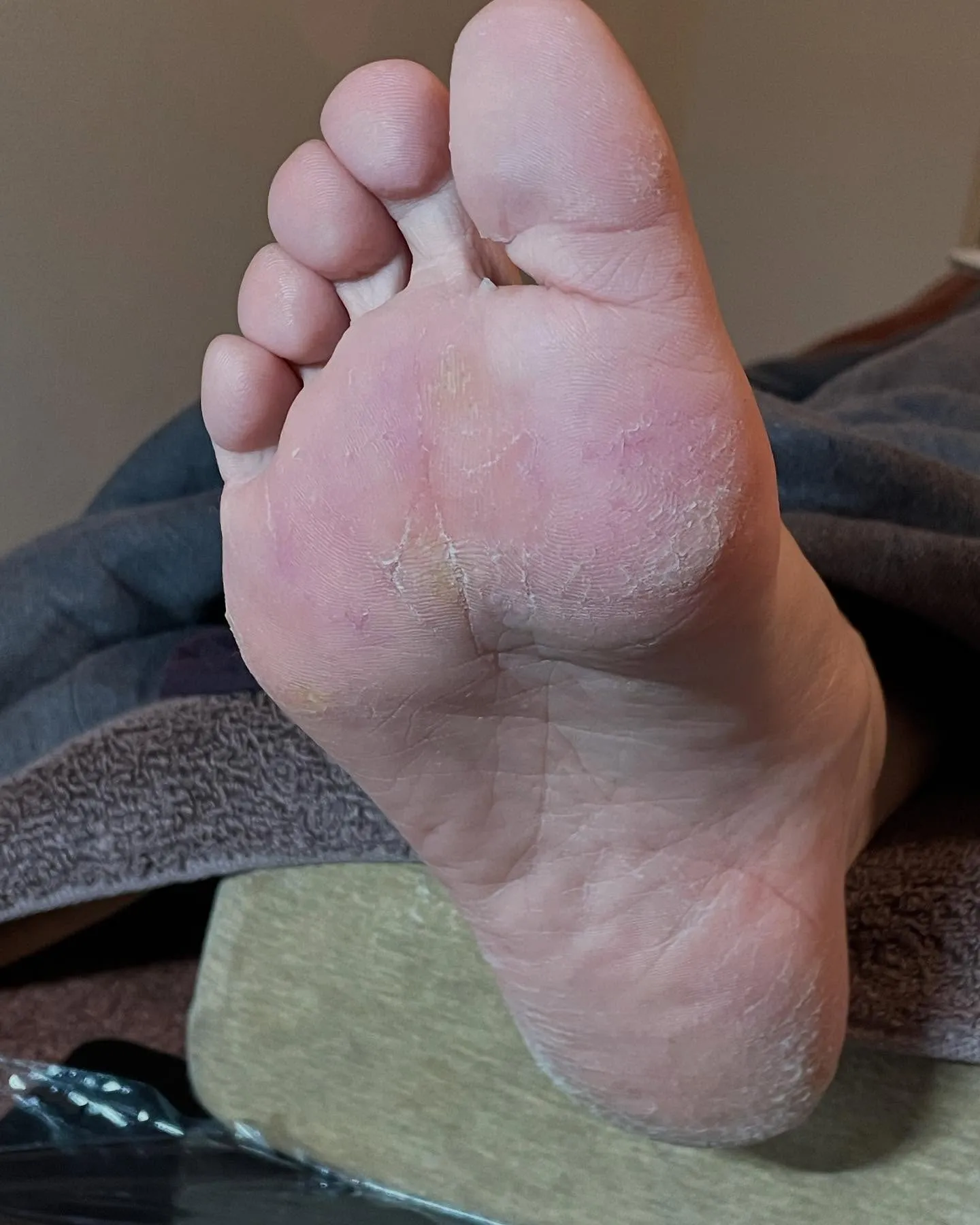 もうすぐサンダルを履く…キレイな素足でいたい!右足編☆