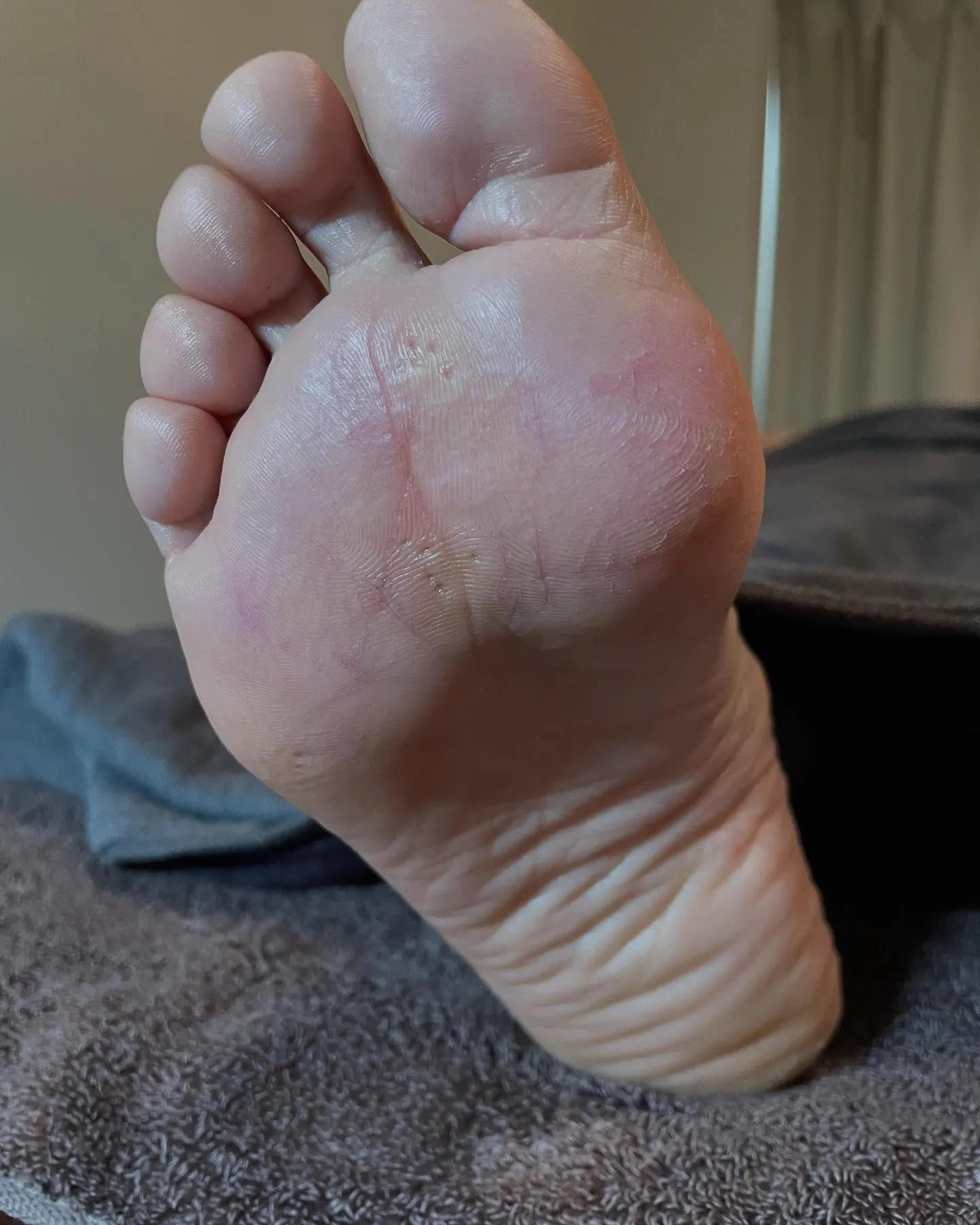 もうすぐサンダルを履く…キレイな素足でいたい!右足編☆