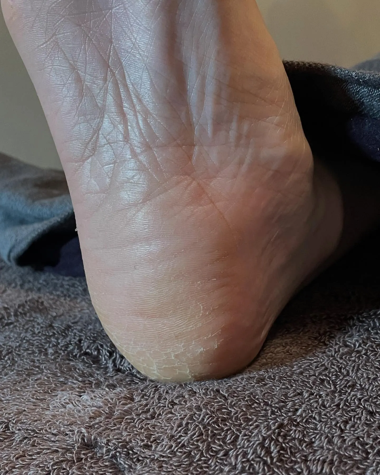 もうすぐサンダルを履く…キレイな素足でいたい!右足編☆