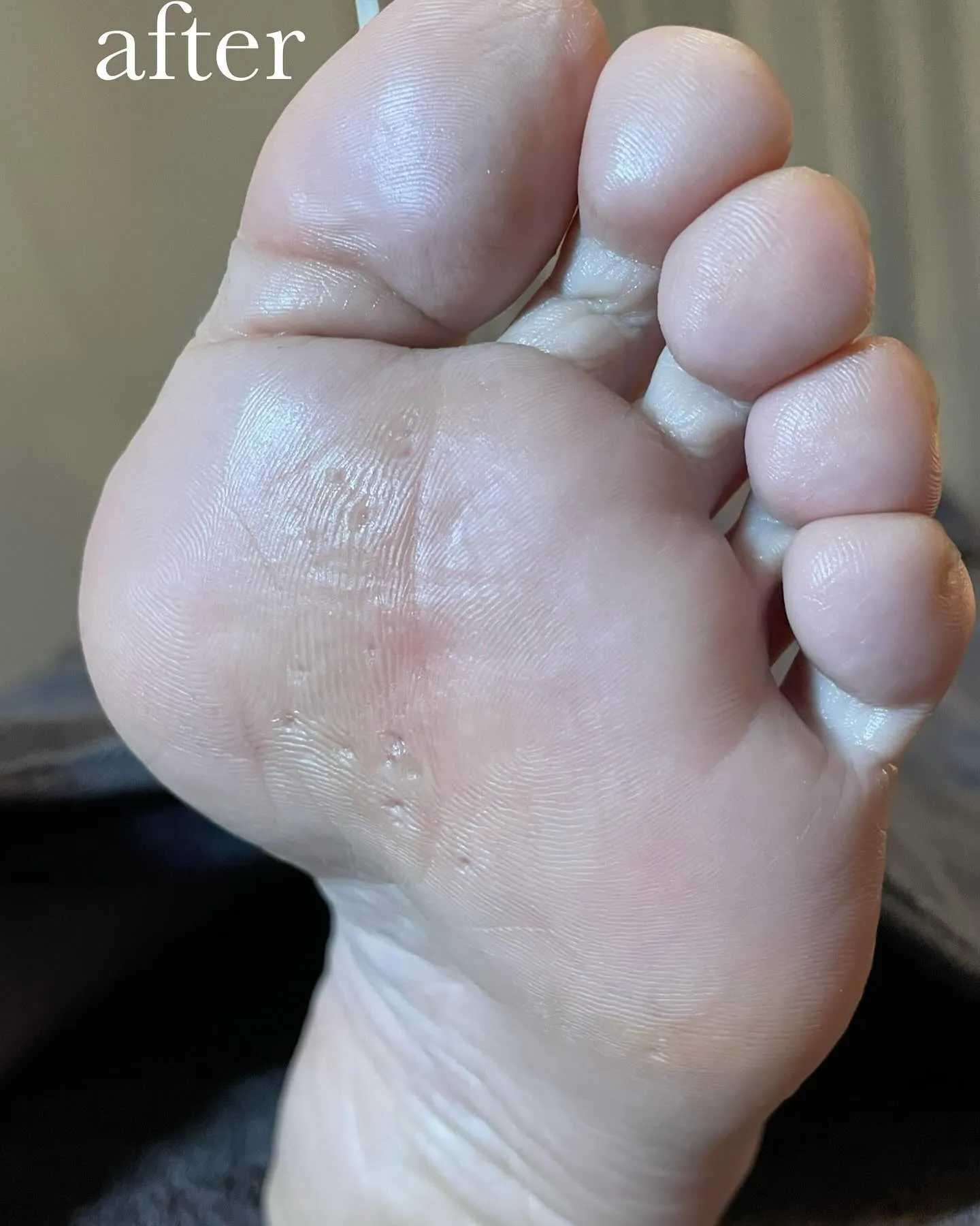 キレイな素足には準備が大切！梅雨.夏にむけてレッツゴー♪左足...