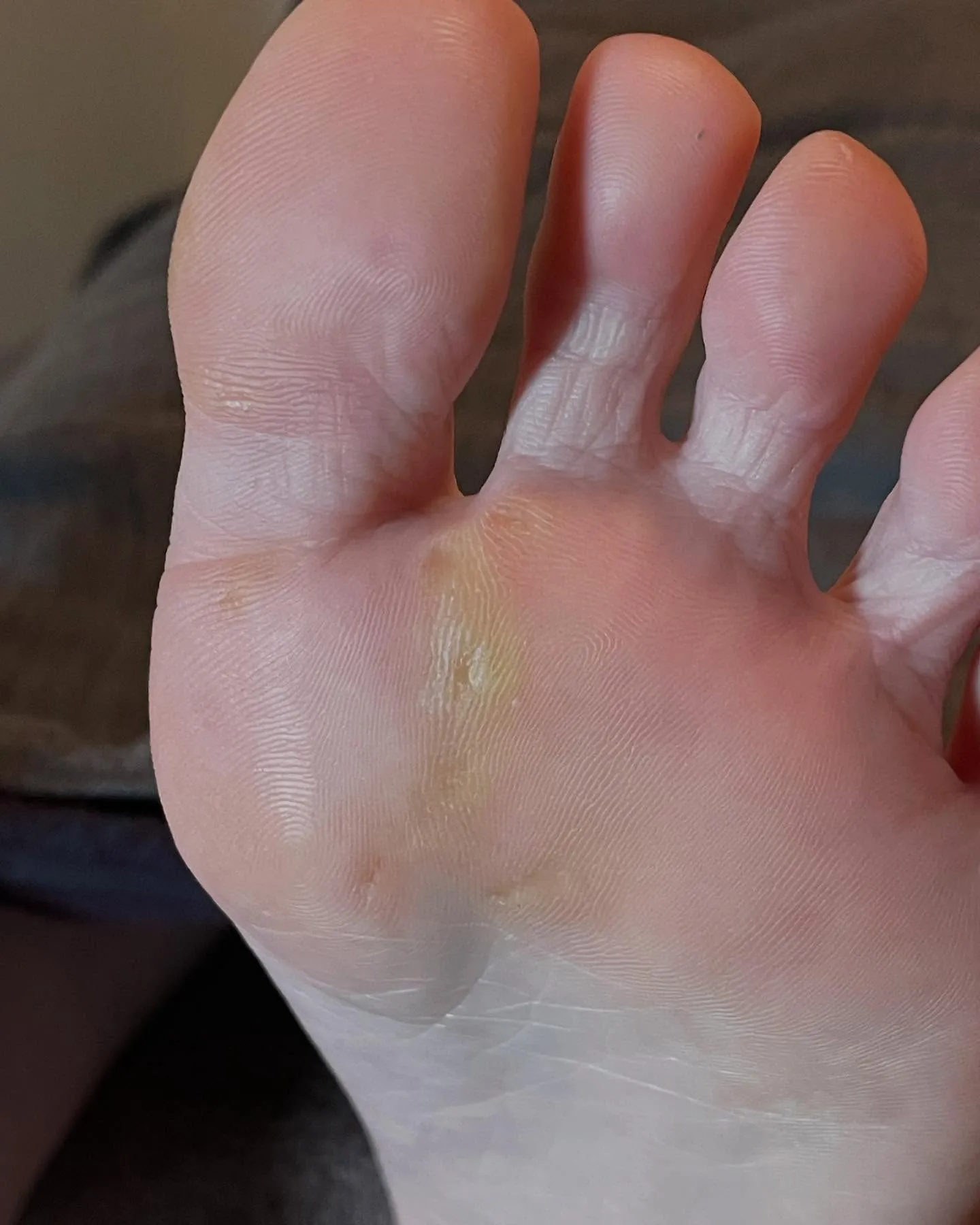 足ケアして「楽になりました！」やっぱり身体の土台が大事✨