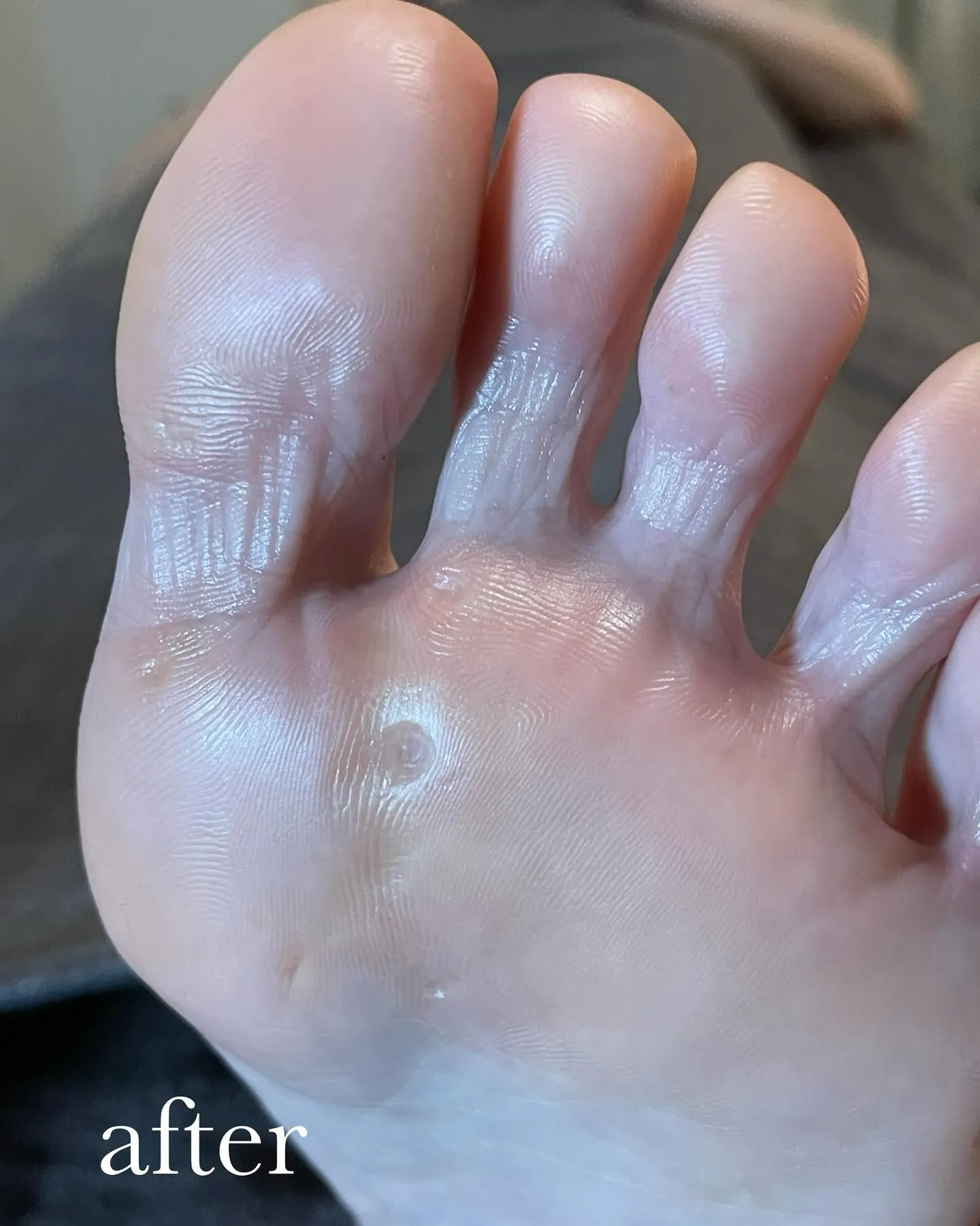 足ケアして「楽になりました！」やっぱり身体の土台が大事✨