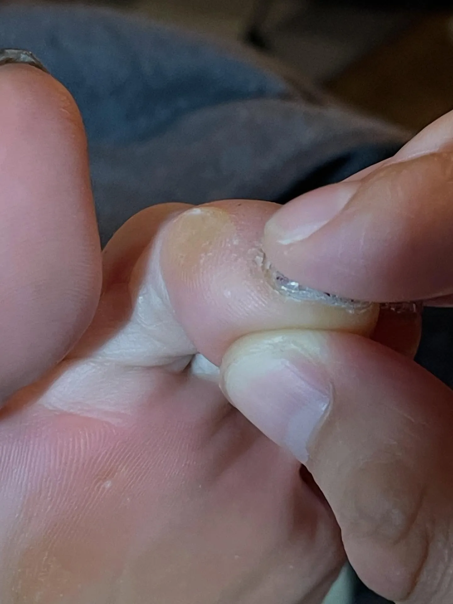 “親指の周りにつくタコ・魚の目”指の横にも！頭〜首に休息を✨