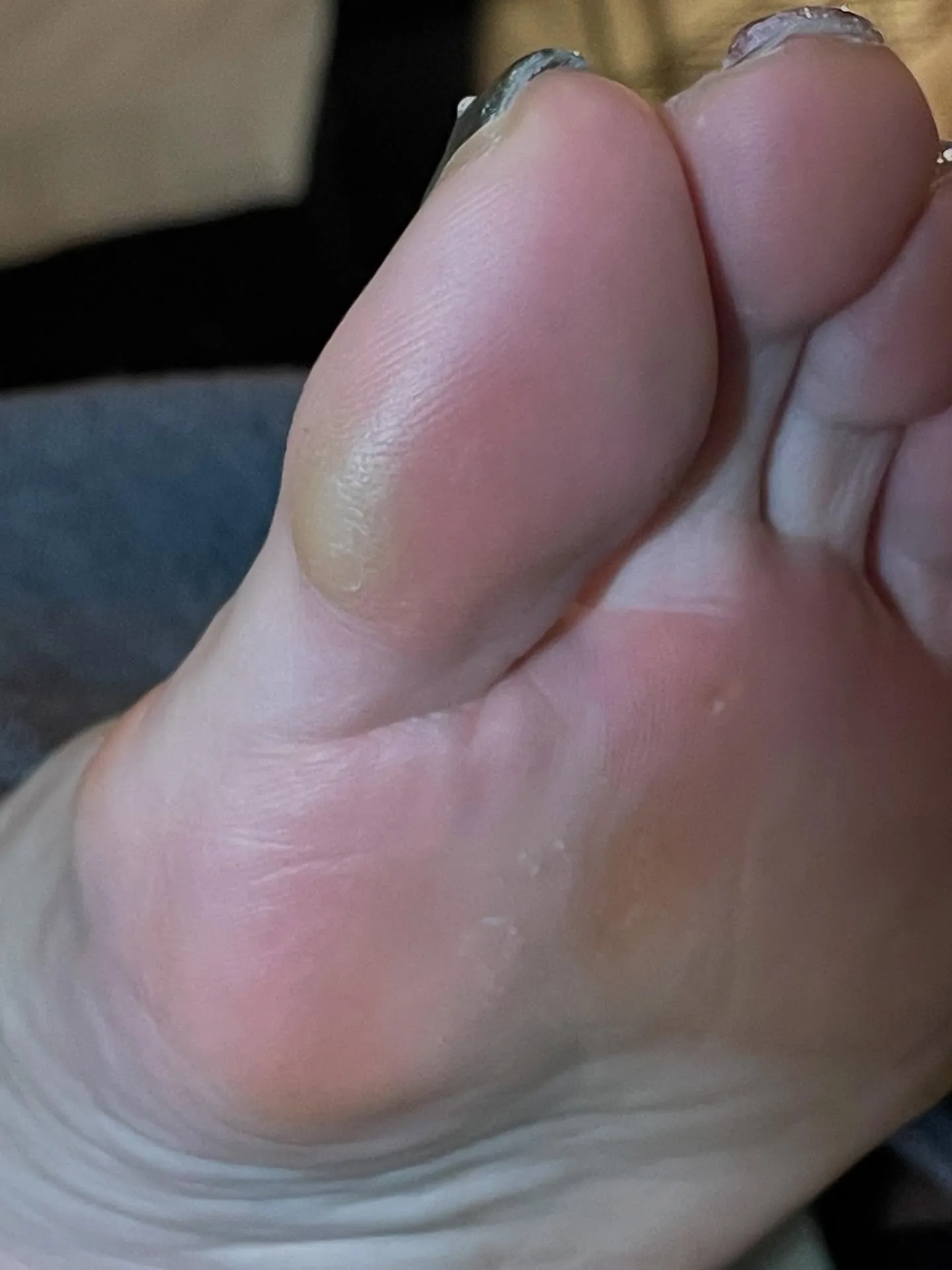 “親指の周りにつくタコ・魚の目”指の横にも！頭〜首に休息を✨