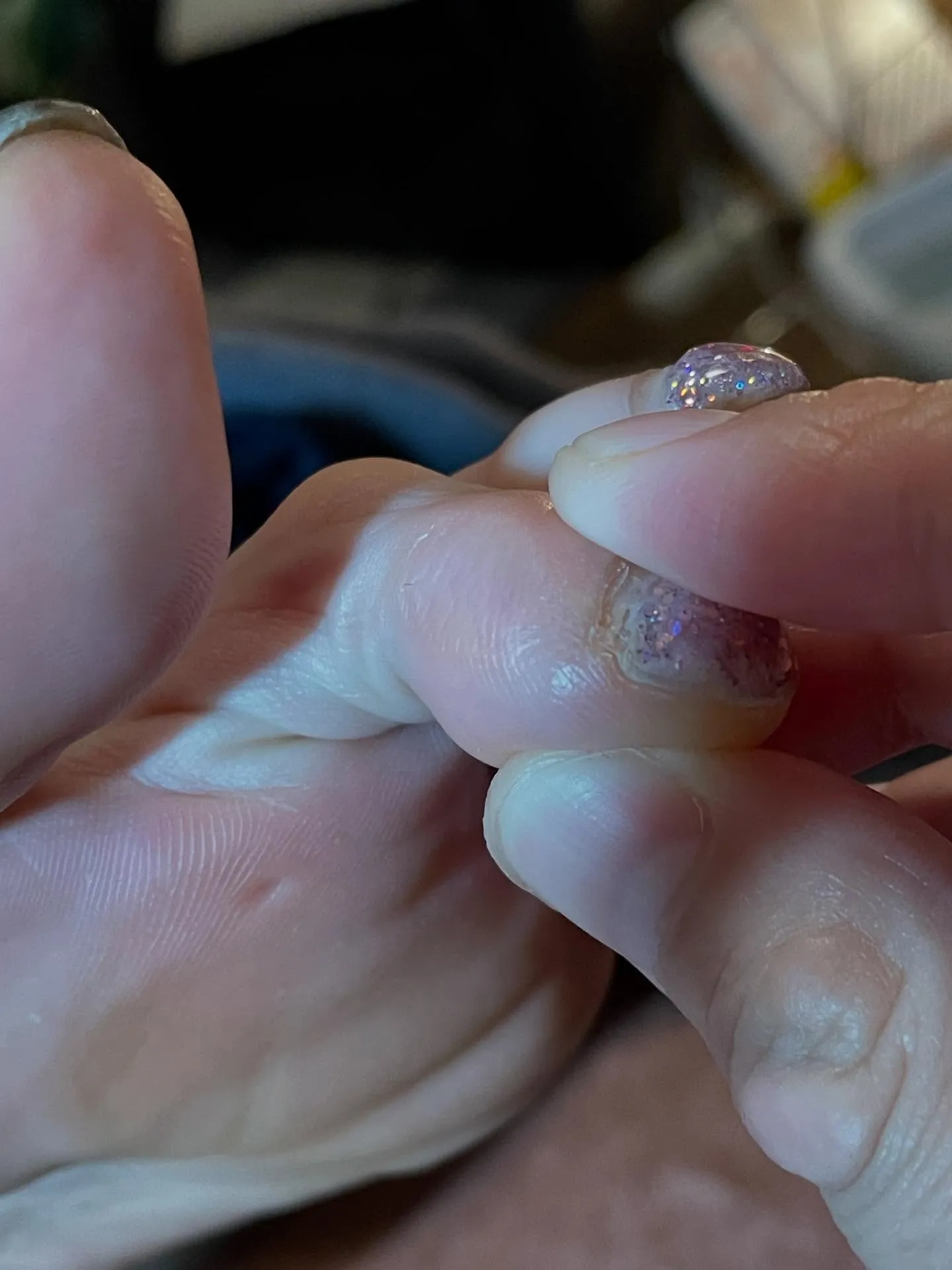 “親指の周りにつくタコ・魚の目”指の横にも！頭〜首に休息を✨