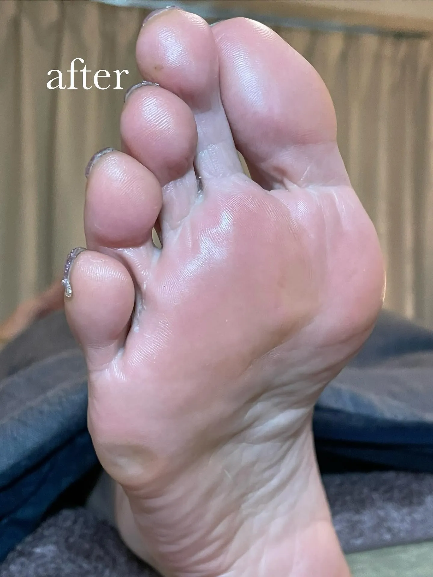 素足キレイ✨を保てていますか？小指の下のタコ辛〜い( width=