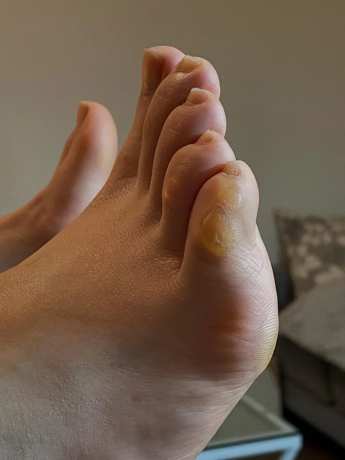 「小指の上にタコ」は、大丈夫❓“集中力”高めて輝く自分に(^...