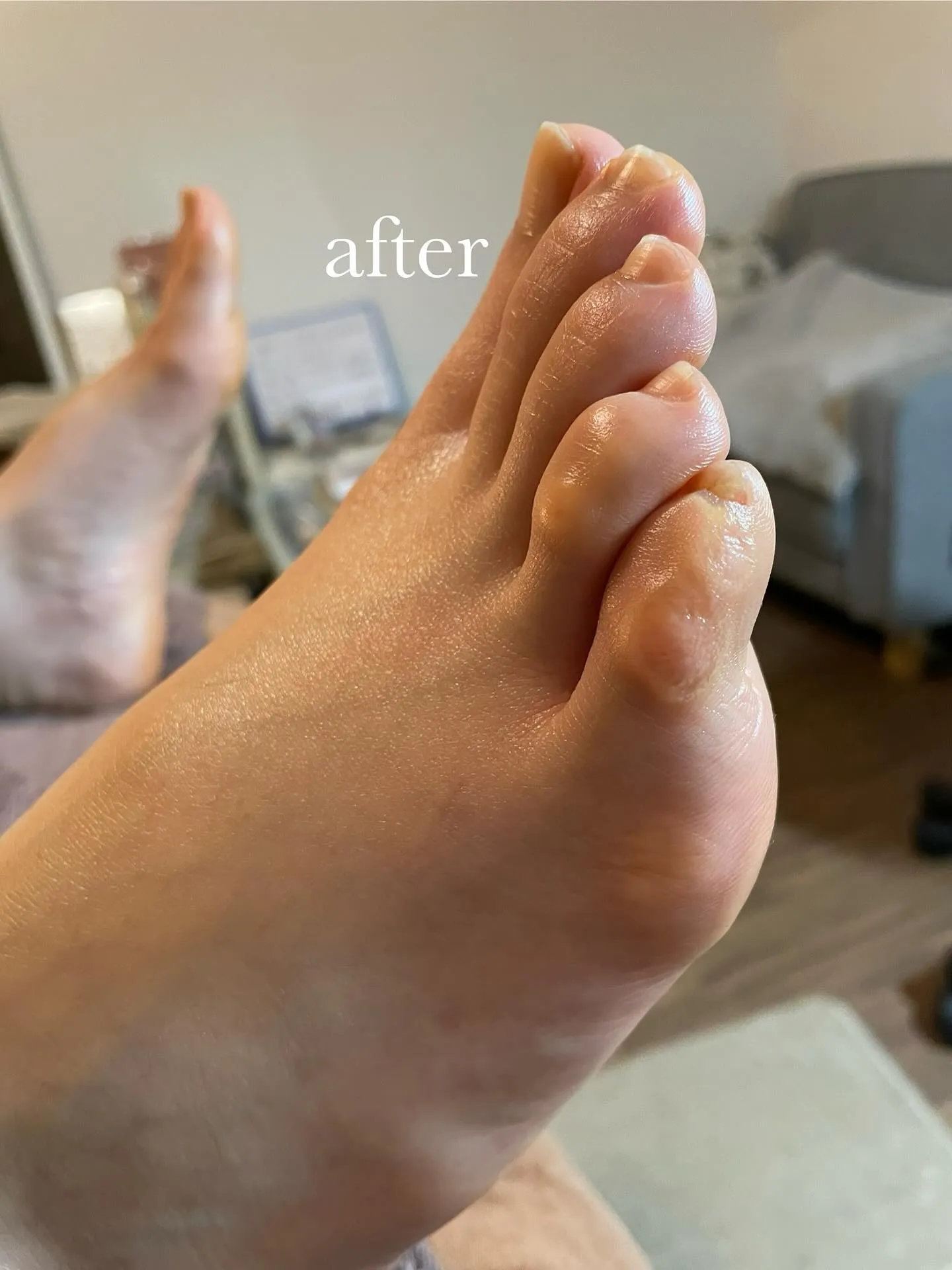 「小指の上にタコ」は、大丈夫❓“集中力”高めて輝く自分に(^...