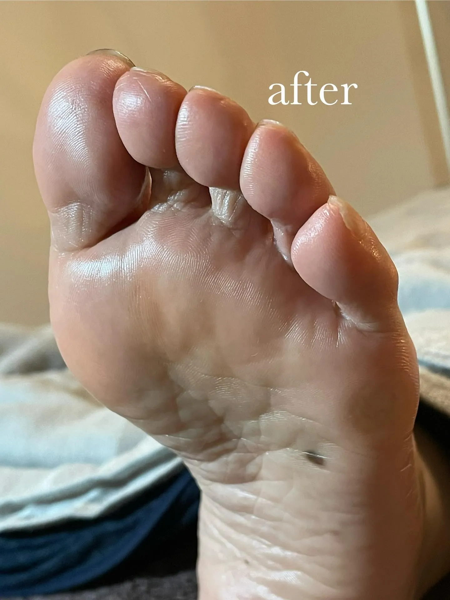 “小指の下のタコ”が解放されるだけで救われる✨姿勢もよくなる...