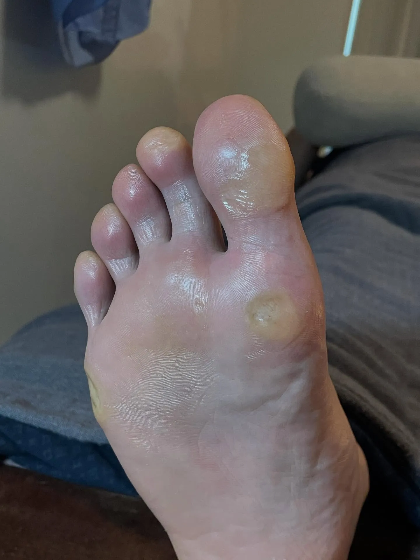 角質ケア＋足つぼ後は快適＆軽やかな足に♪靴カパカパ〜笑