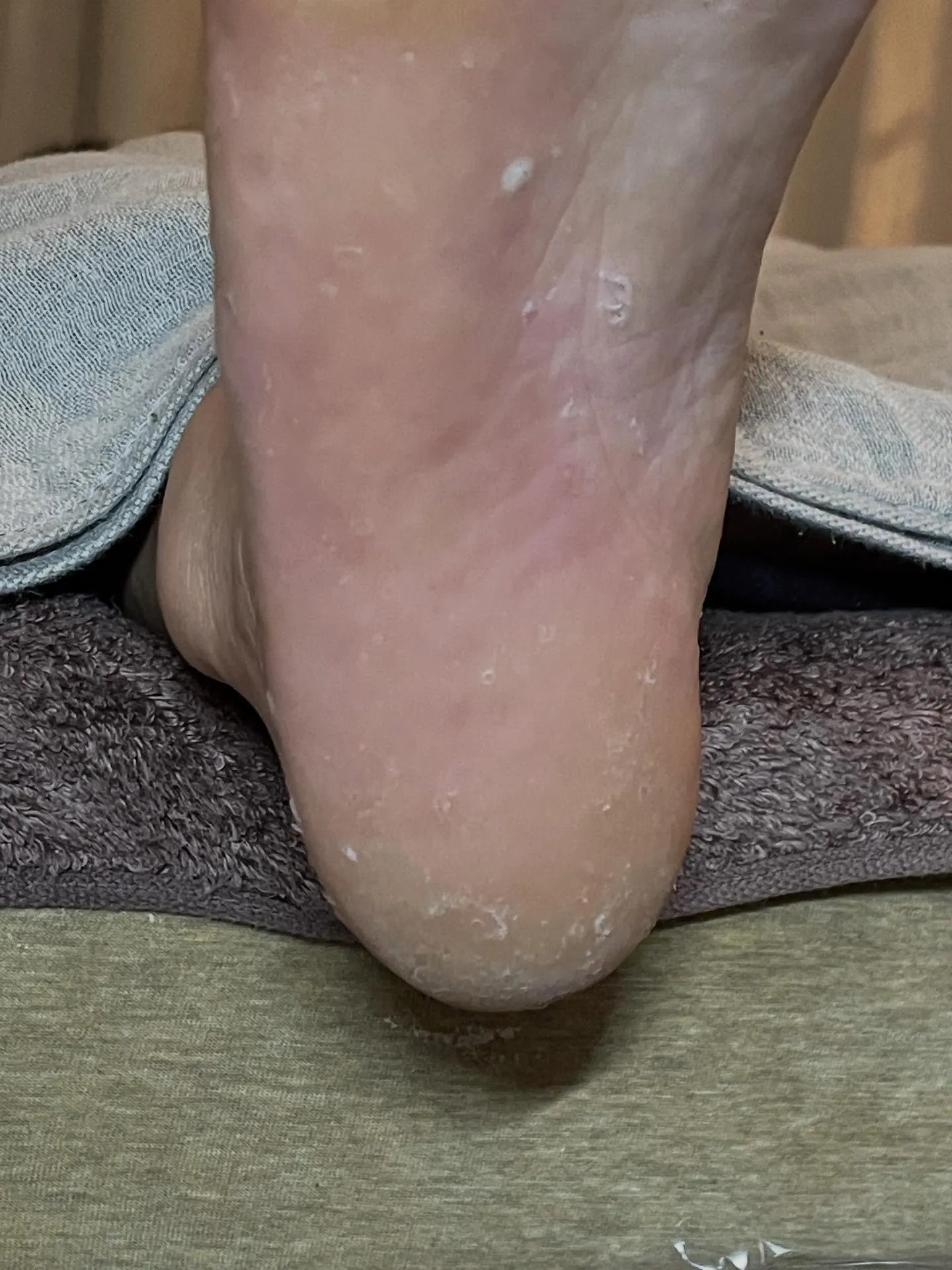 頭痛、めまいは大丈夫でしたか？Orionで健康的な足に身体に...