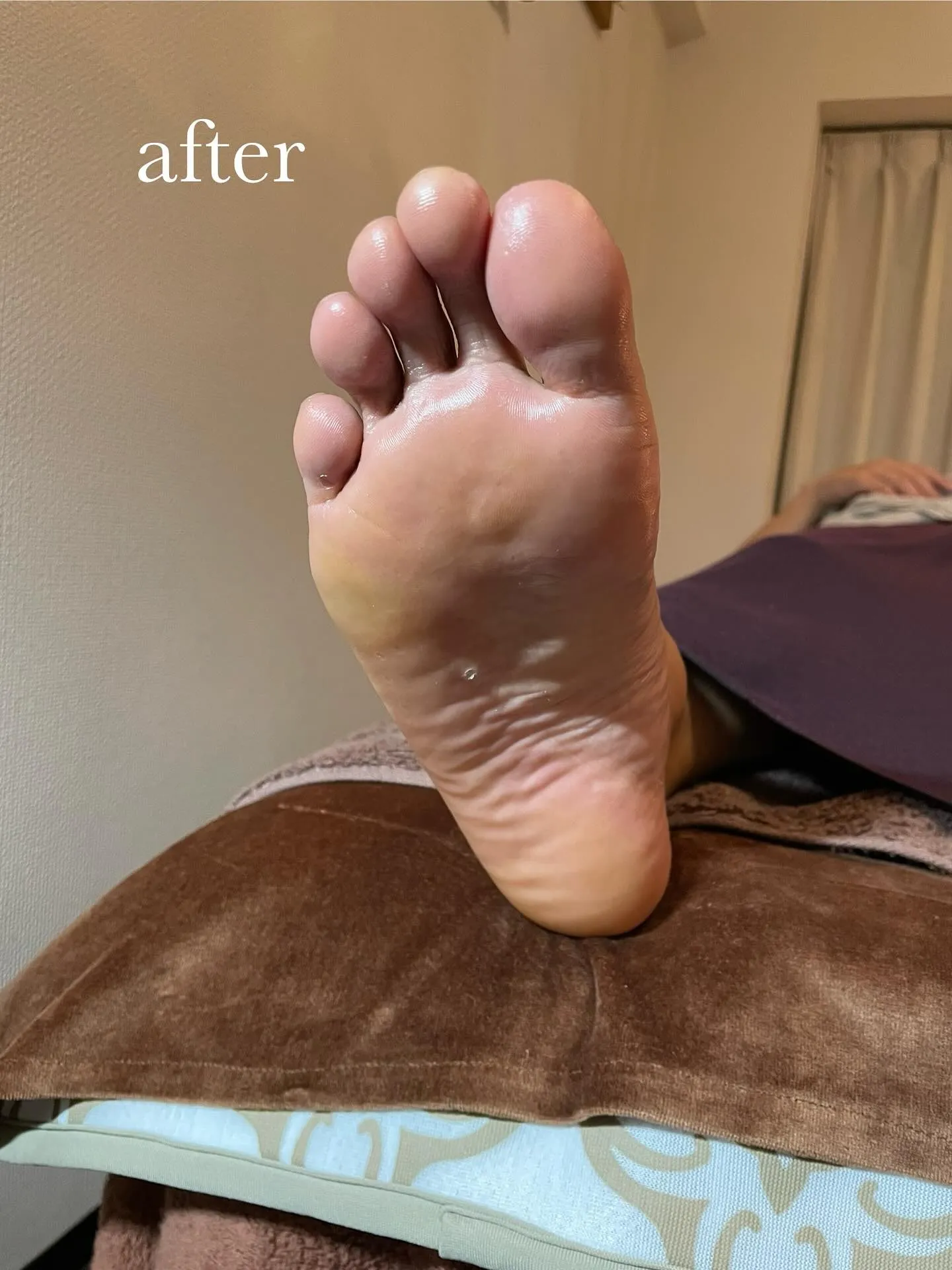 頭痛、めまいは大丈夫でしたか？Orionで健康的な足に身体に...