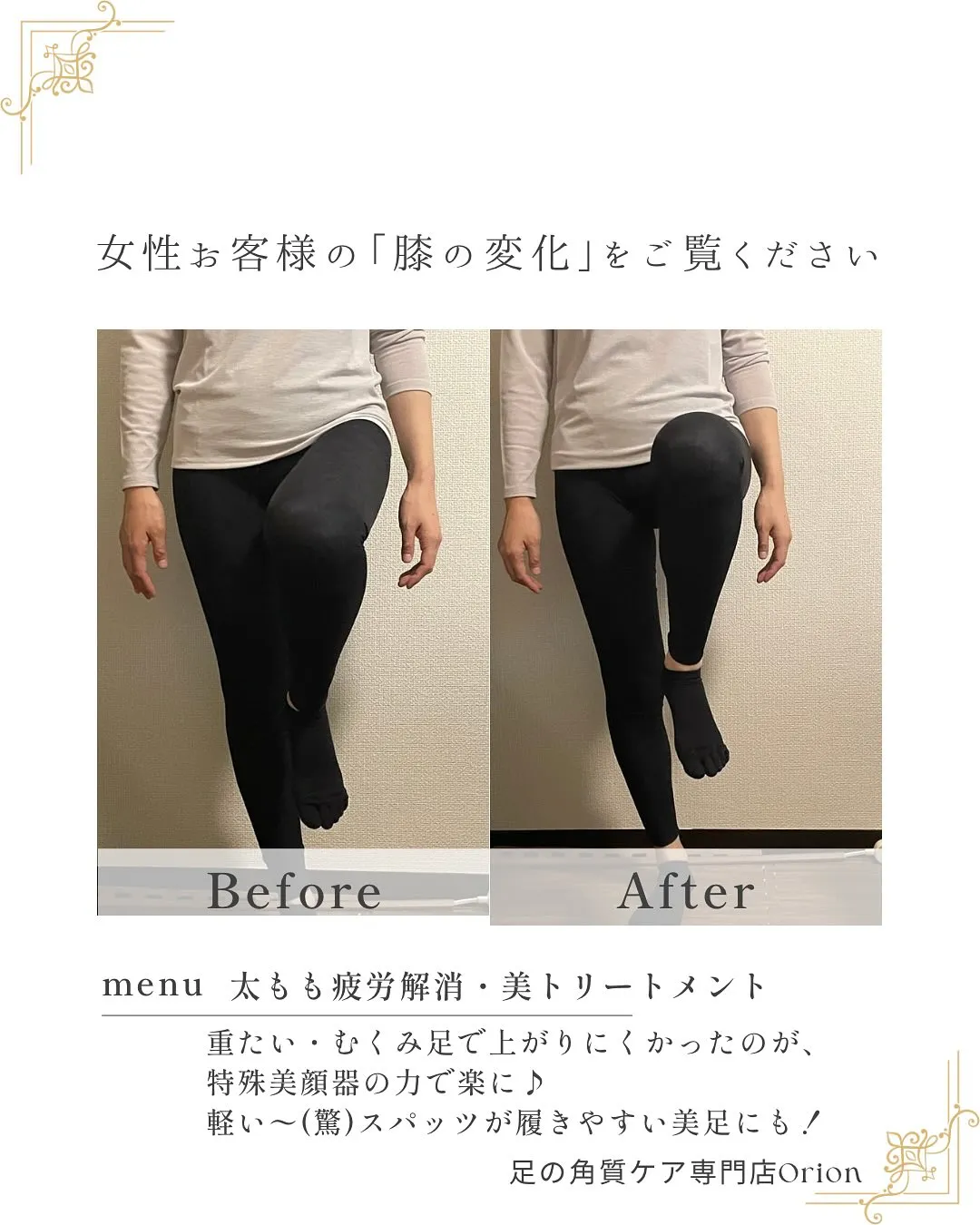 「太もも疲労解消・美トリートメント」を足つぼ後にしてみて(^...