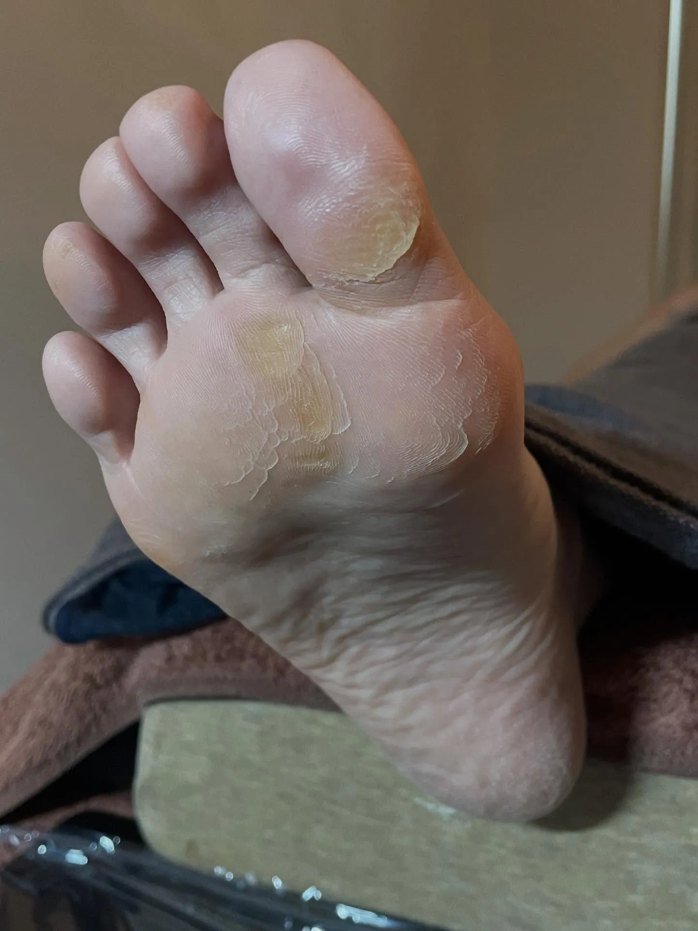 夏のダメージが素足に(｡-_-｡)乾燥の時期をどう過ごす⁉️