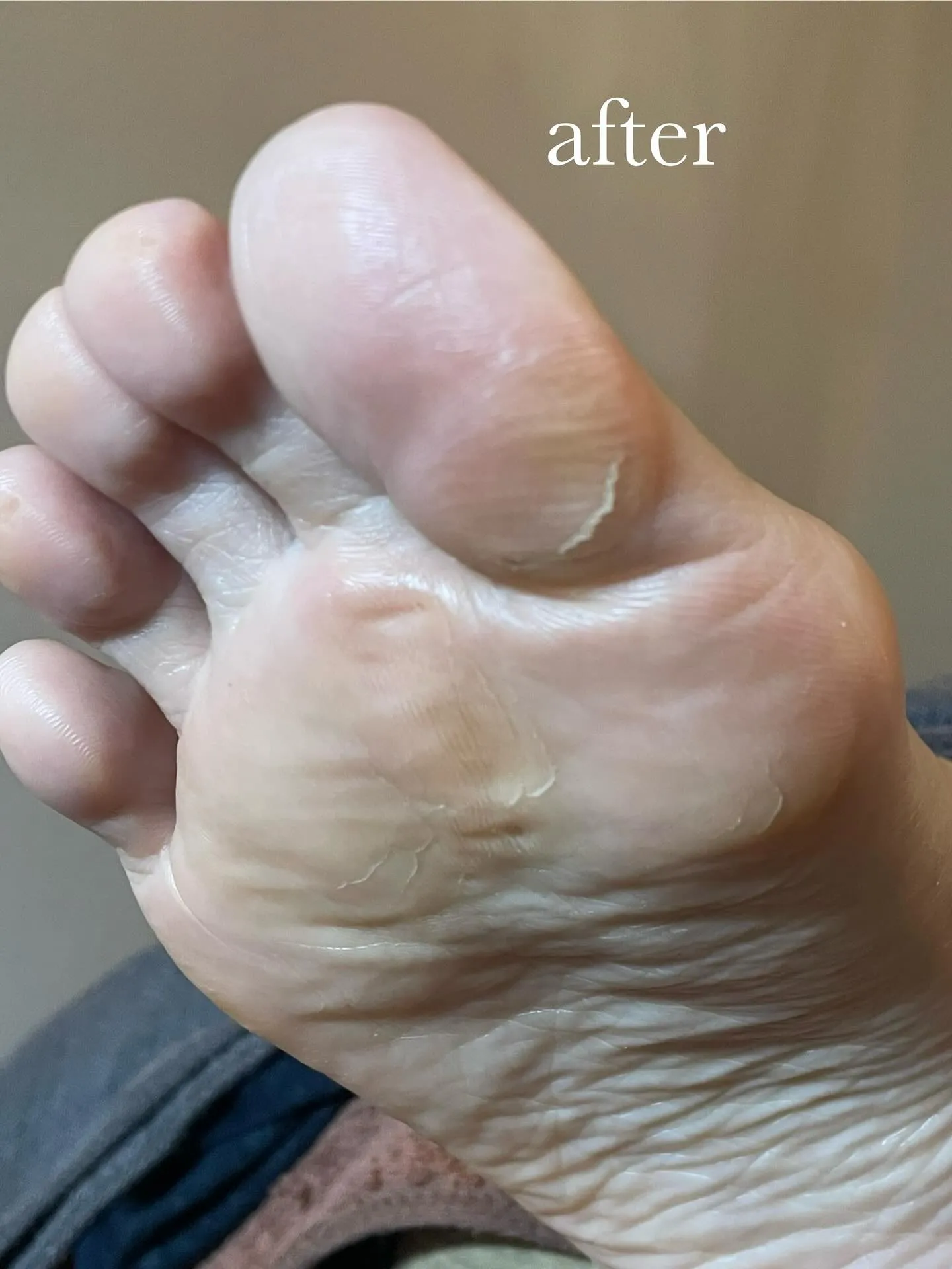 夏のダメージが素足に(｡-_-｡)乾燥の時期をどう過ごす⁉️