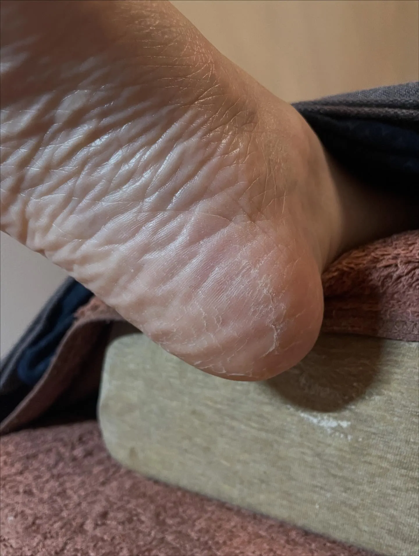 夏のダメージが素足に(｡-_-｡)乾燥の時期をどう過ごす⁉️