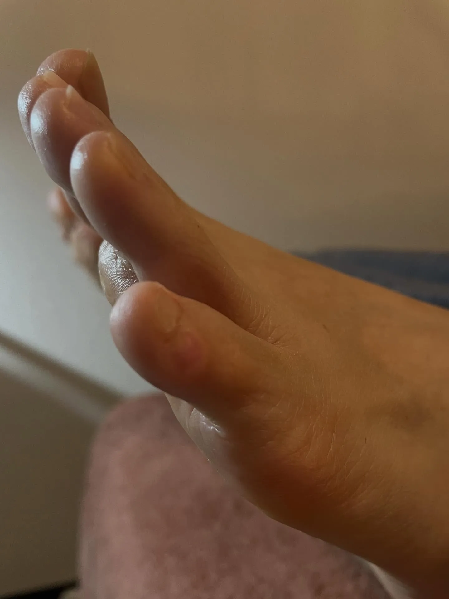 何か違和感!隠れて魚の目が… 真ん中から小指から(ノ_<)