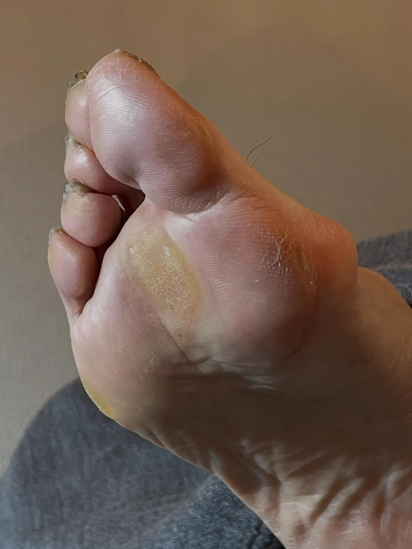 すこし足痛かった、、首も！これで安心して温泉はいれる♪