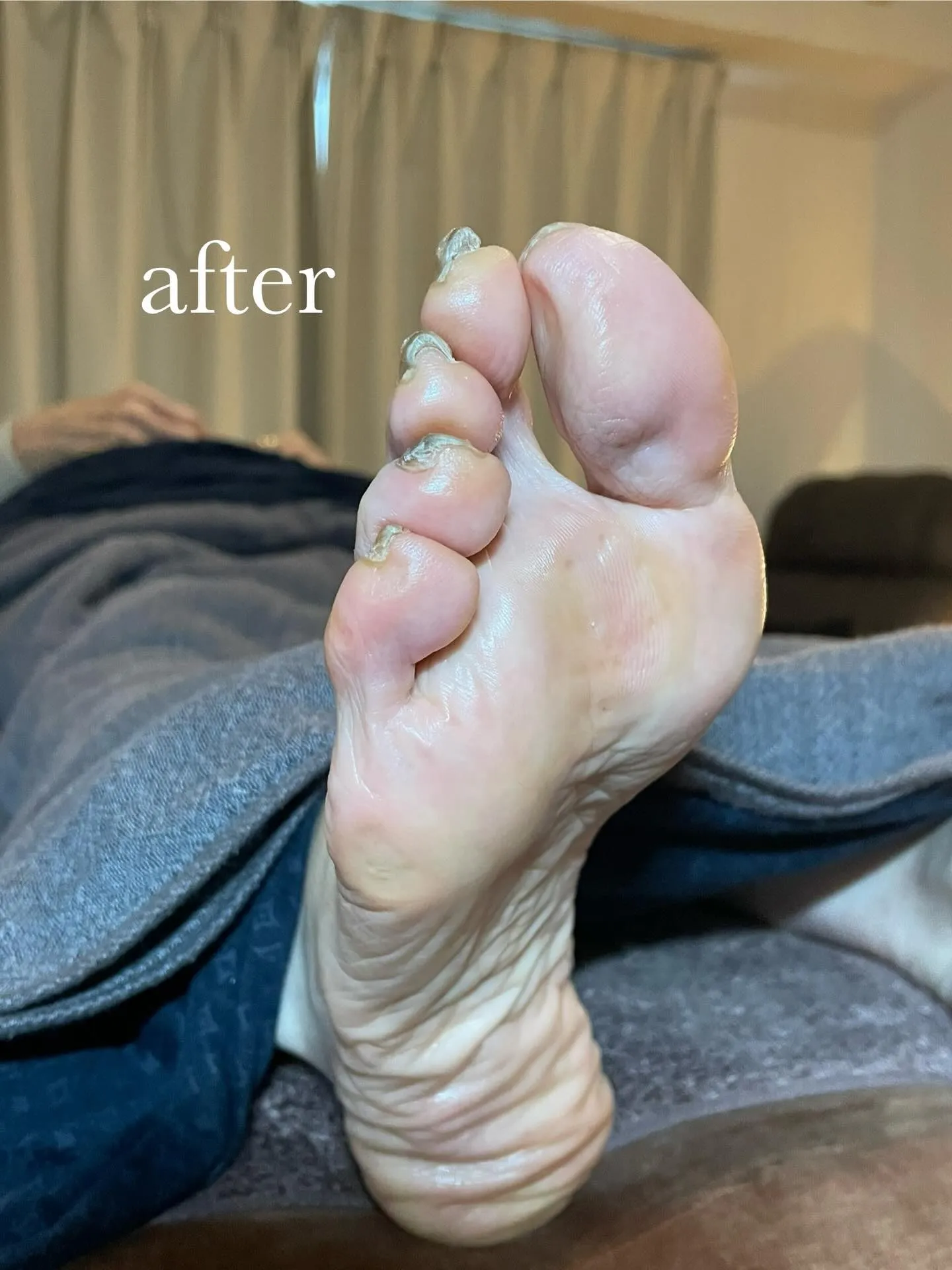 すこし足痛かった、、首も！これで安心して温泉はいれる♪