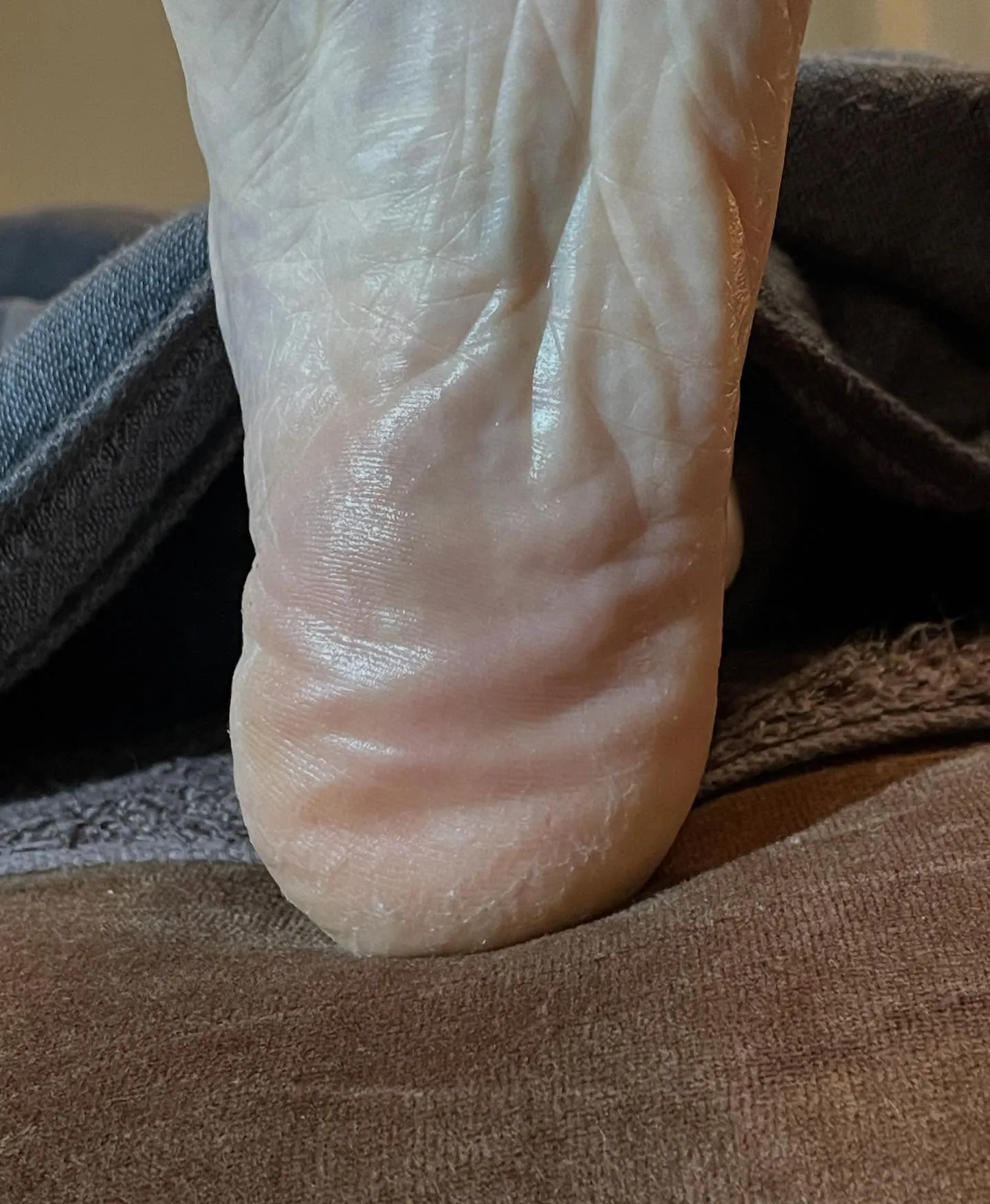 かかとガサガサ…ひんぱんに起こる!靴の中でこすれてるかも∑(...