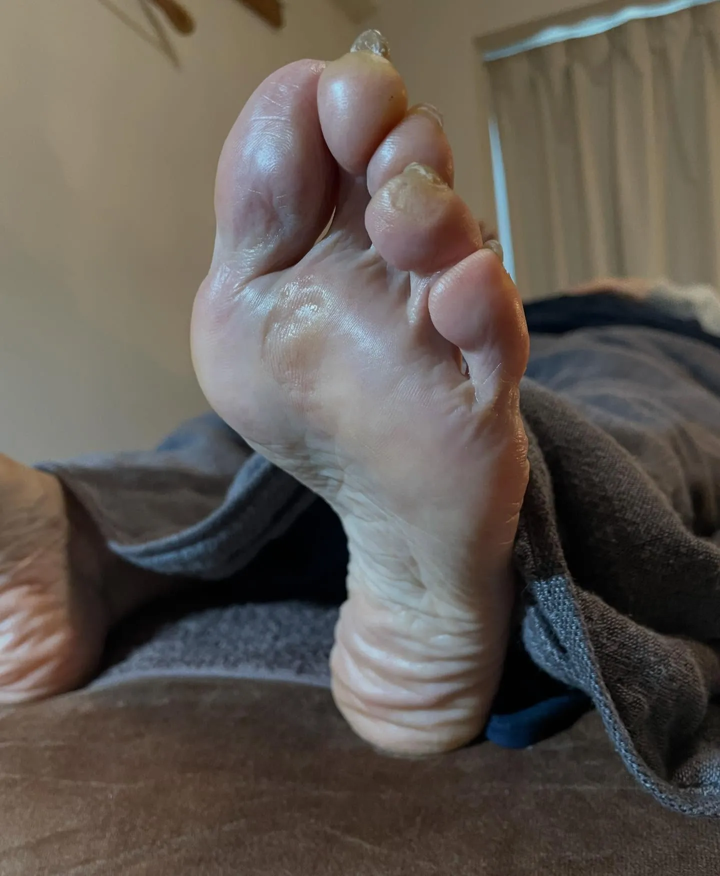 かかとガサガサ…ひんぱんに起こる!靴の中でこすれてるかも∑(...