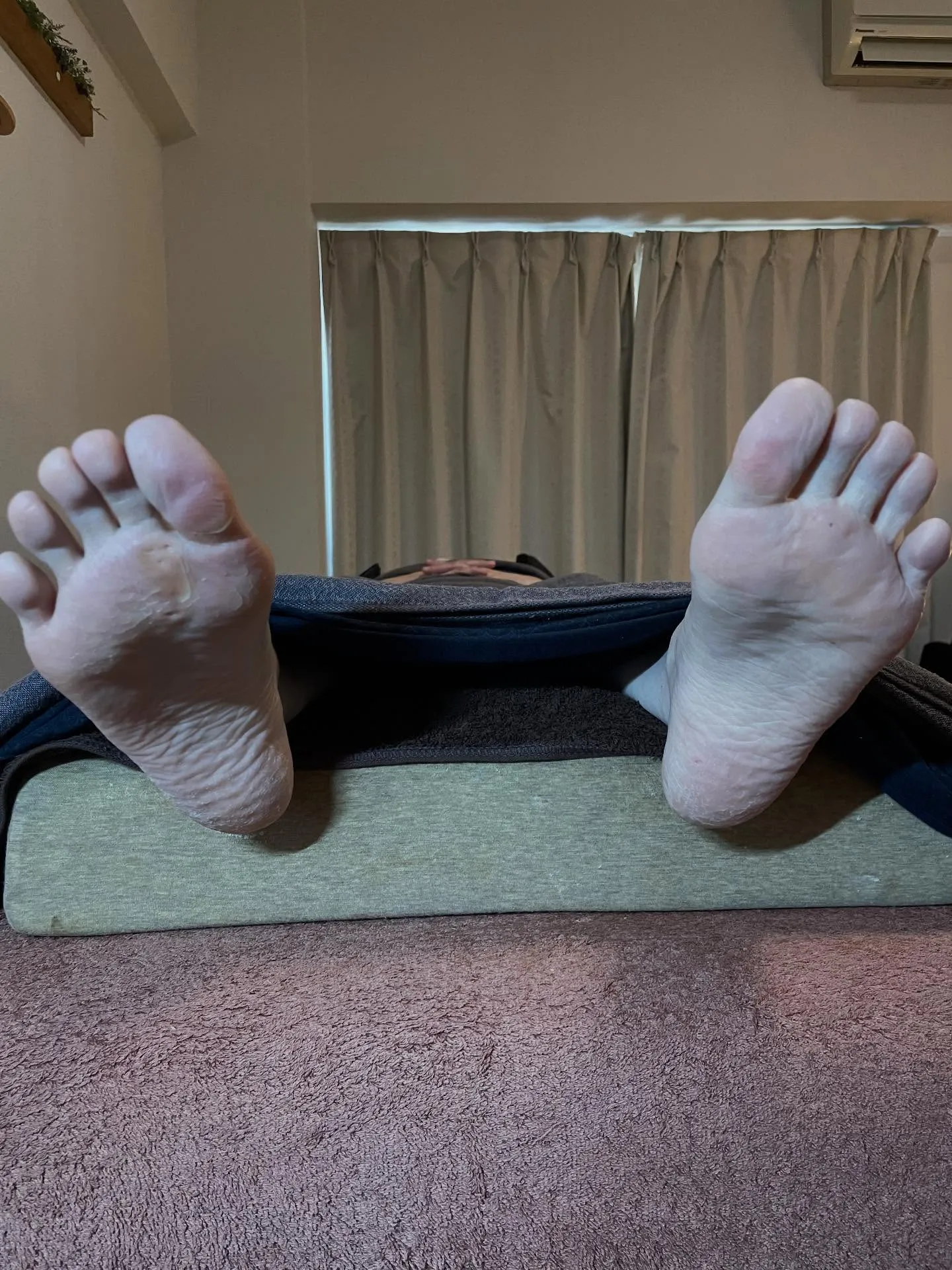 「かかとに魚の目が…」本人もまさかそんな所にあるなんて(驚)