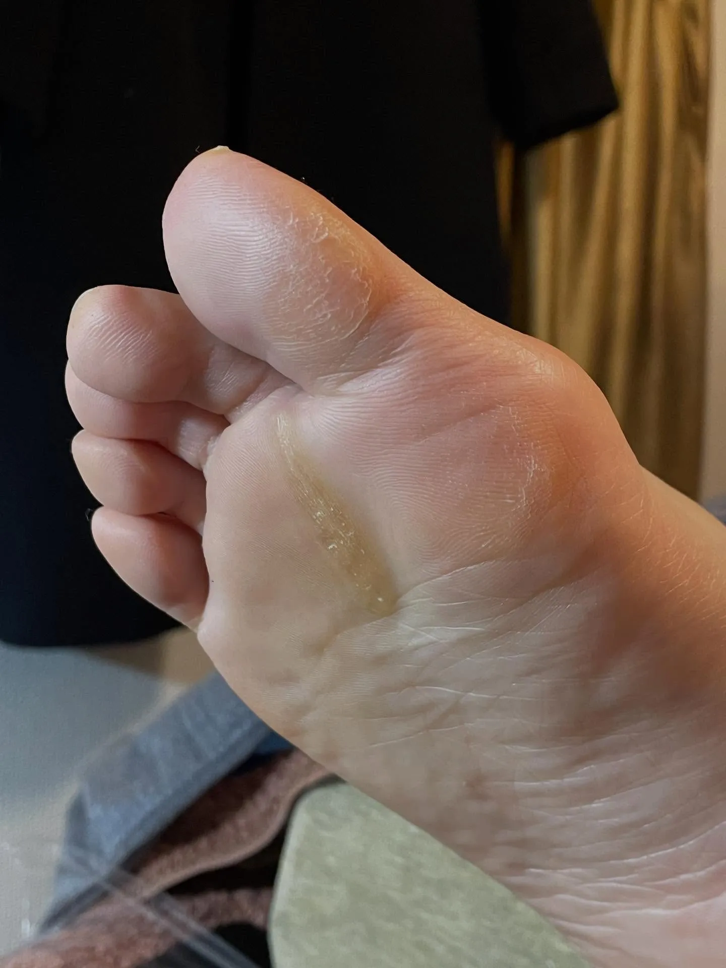 「かかとカサカサ」と「親指タコ」を解消して体調リセット◎