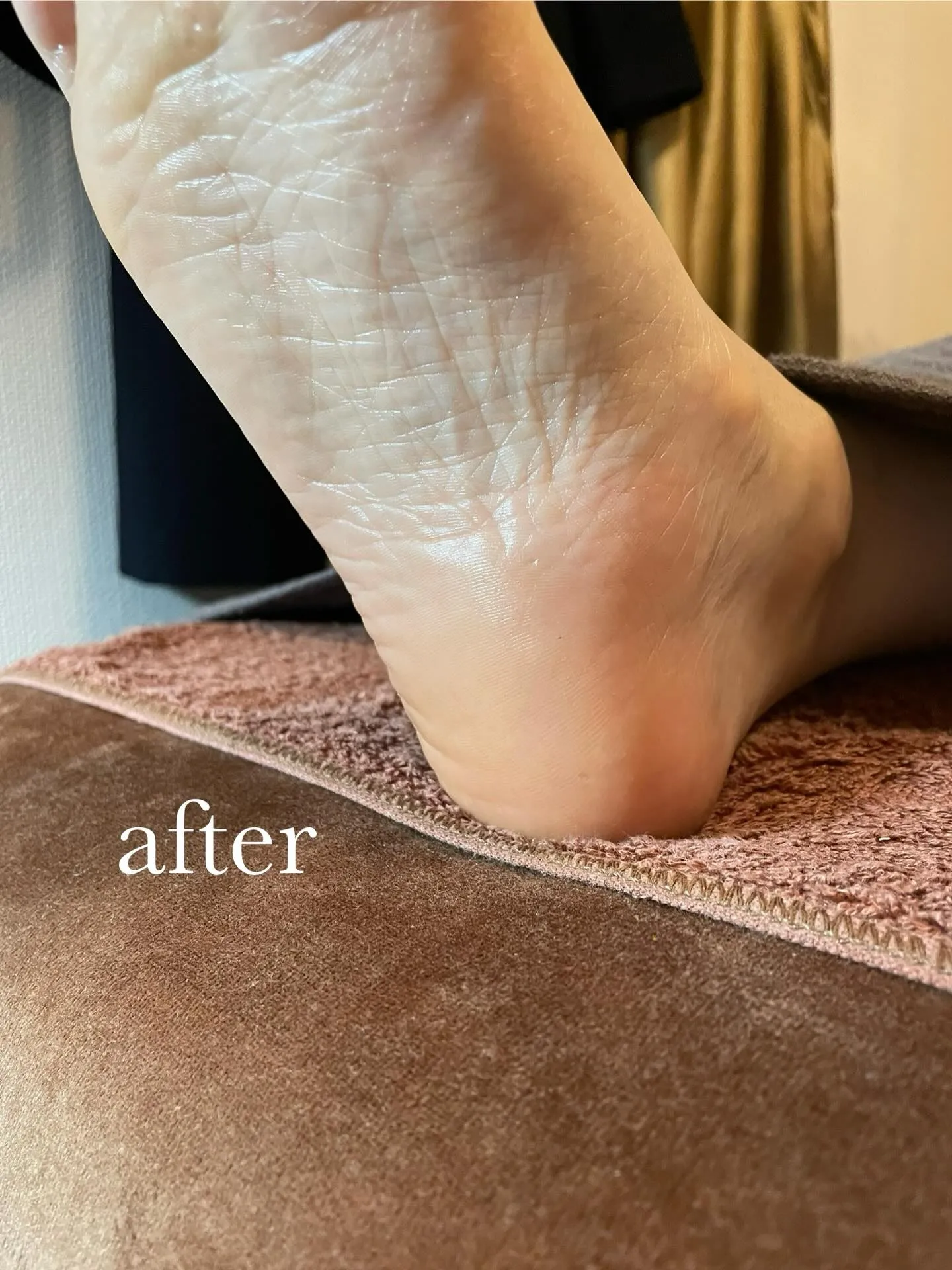 「かかとカサカサ」と「親指タコ」を解消して体調リセット◎