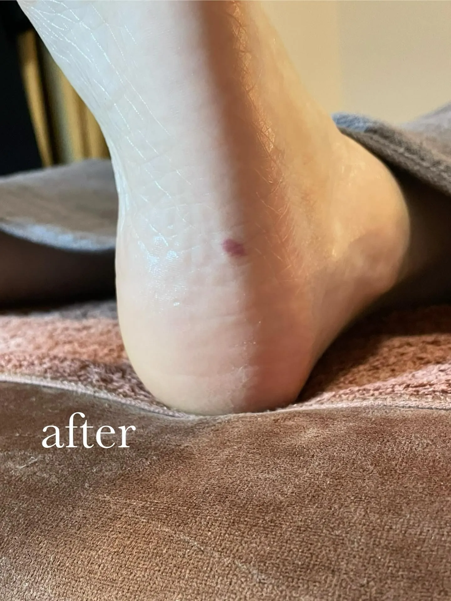 「かかとガサガサ」ケアは子宮系のお悩みや妊活の方にとっても大...