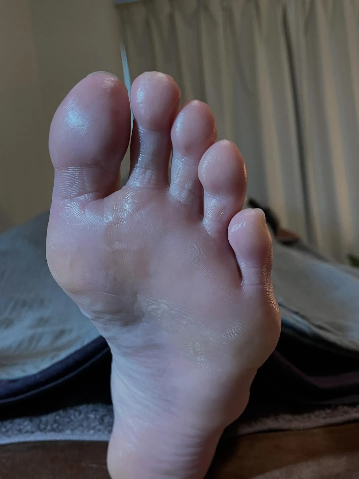 足ってこんなに浮腫んでいるんだ…。