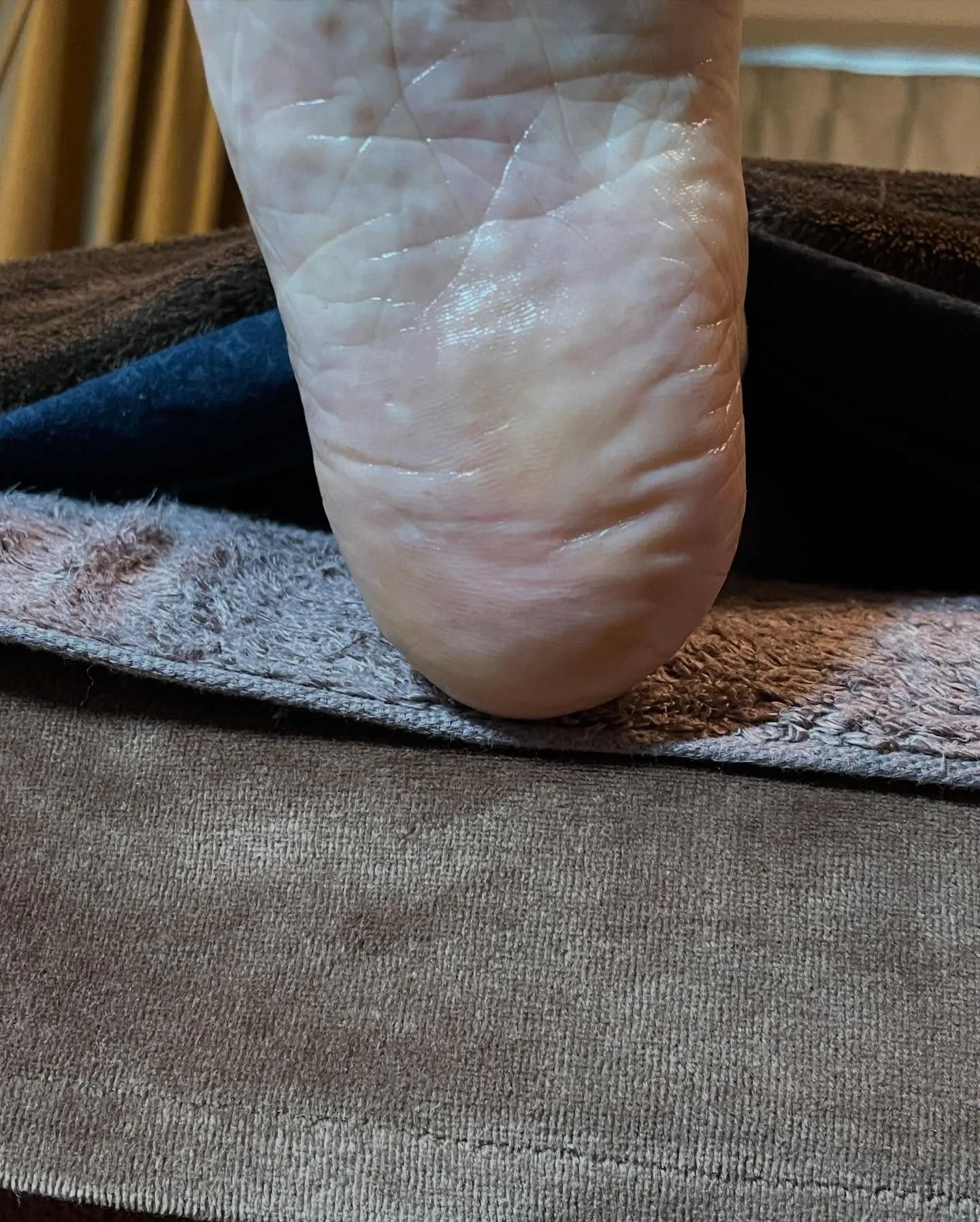 長年の悩みだった足裏の大きいタコ、かかとガサガサも…