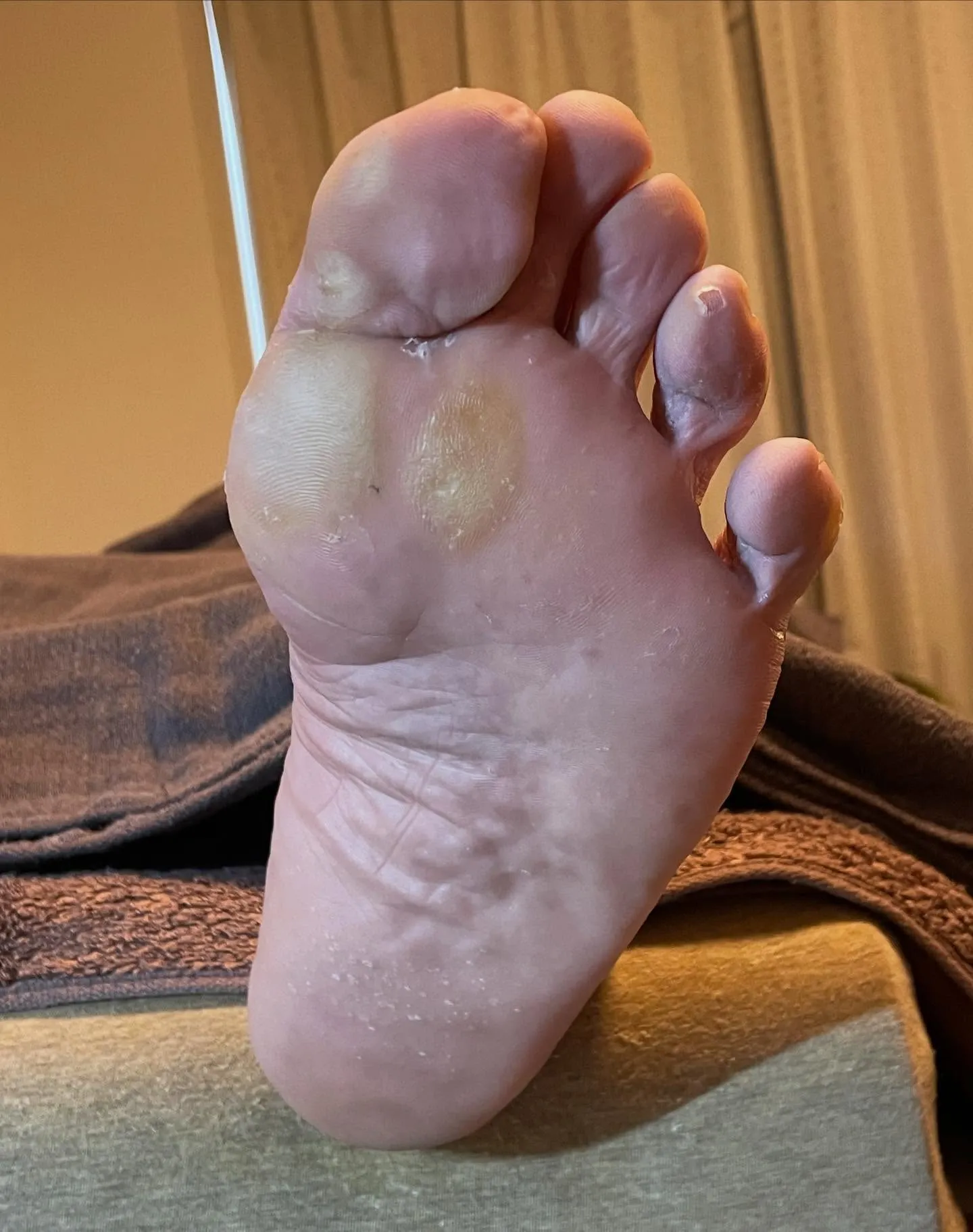 自分でタコ削ったけど、まだ痛い…。