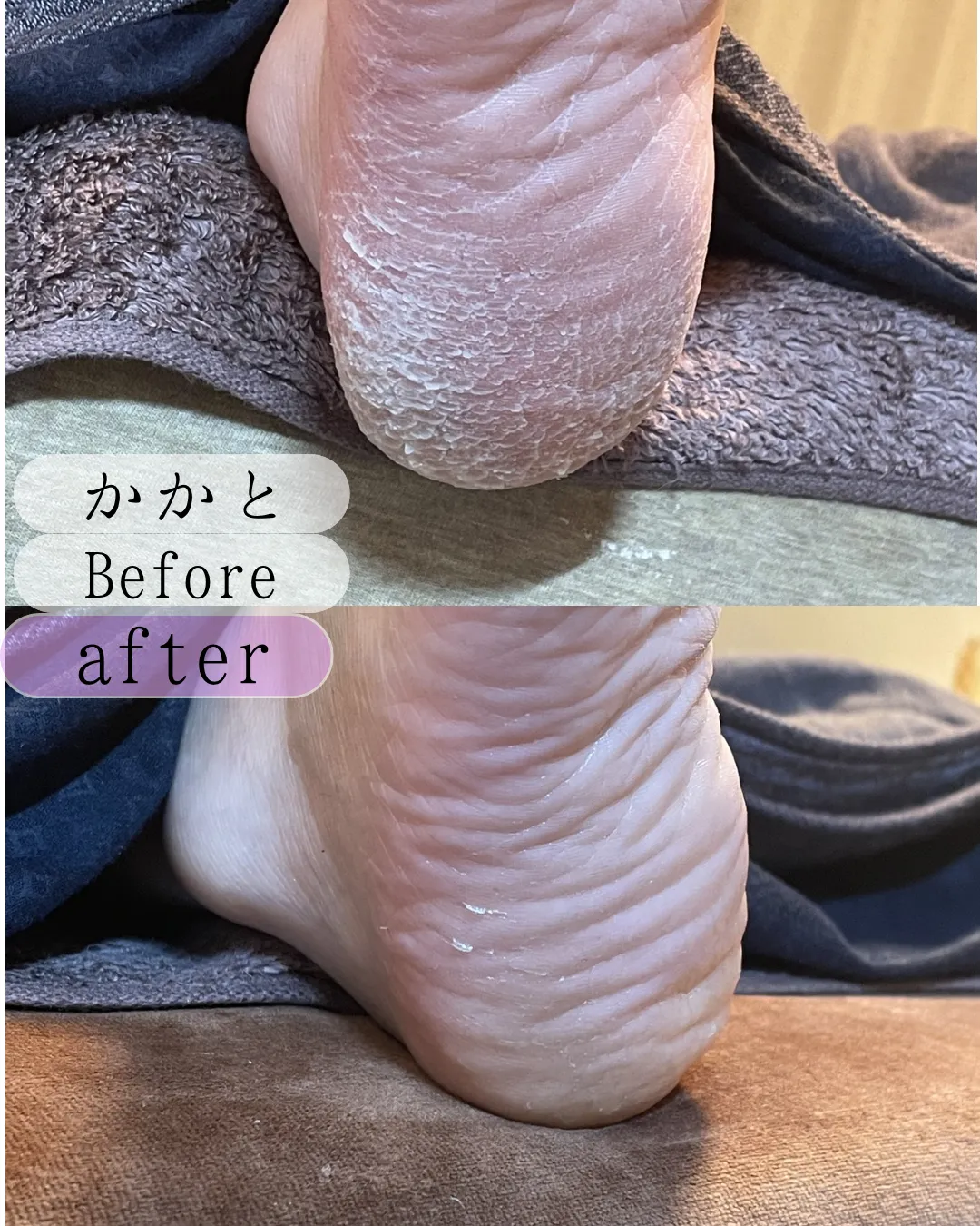 スルッと触れる気持ちいい素肌へ
