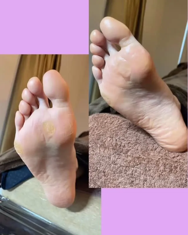 「足裏のタコ、ヒールだこ、小指の下のタコ」全部まとめてキレイ...